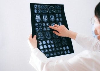 Neuropathy Treatment